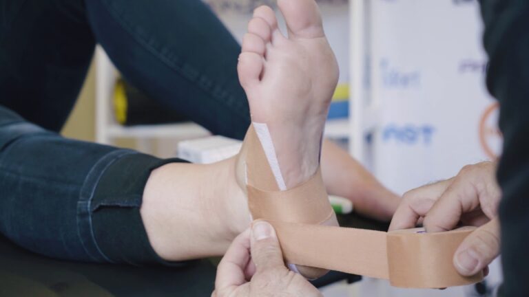 plantar fascia taping